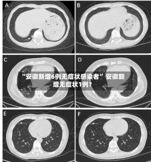 “安徽新增6例无症状感染者” 安徽新增无症状1例？-第2张图片